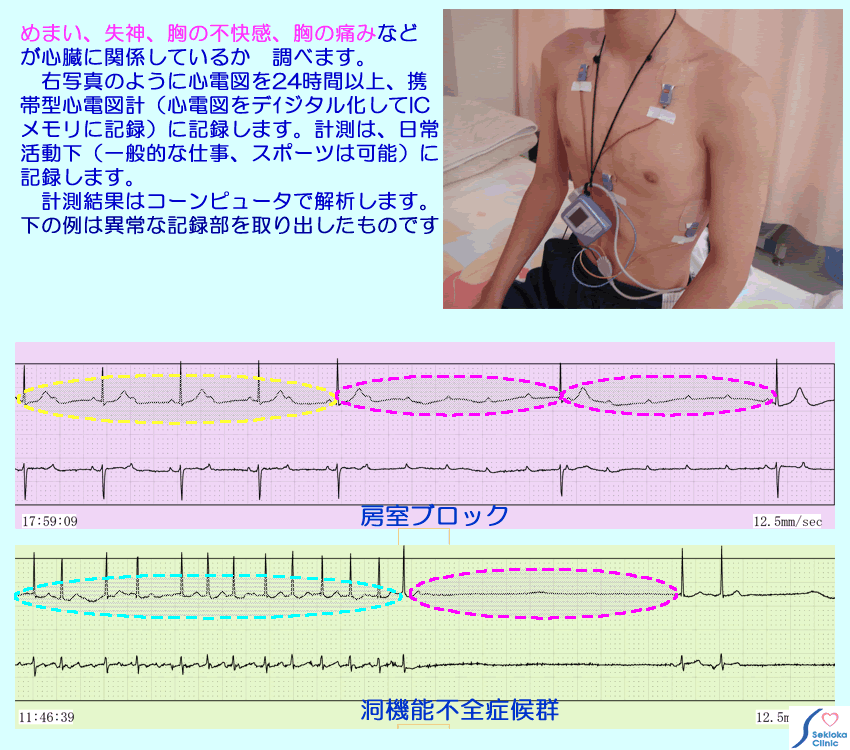 不整脈の検査