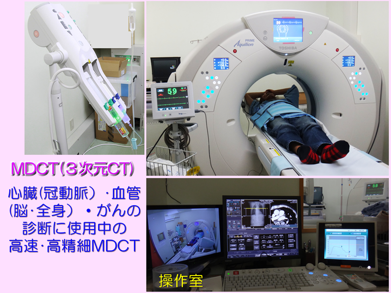 最新MDCT装置